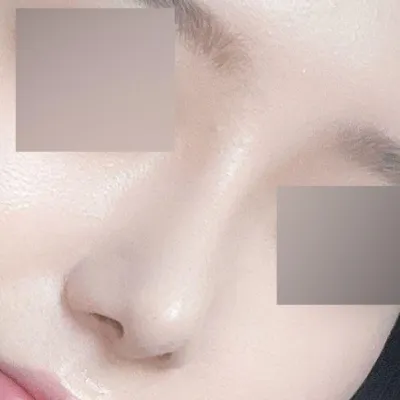 已經手術一個月了