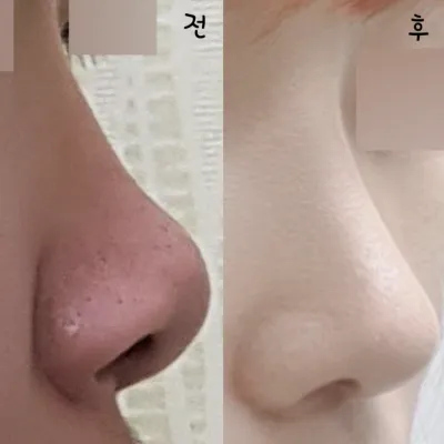 手術後，我變得更有自信了！！