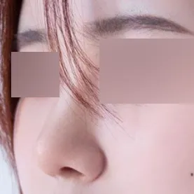 如果對鼻子有顧慮，我強烈推薦~