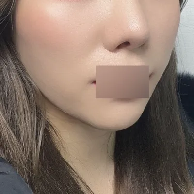 蜜桃線雕拉提3個月後記