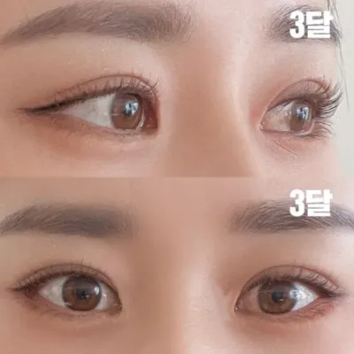 他們按照我想要的風格做了很好的手術！！