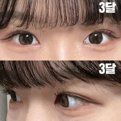 我給沈正煥院長做了內外眼線手術。