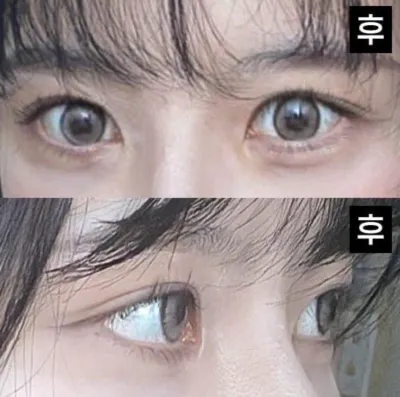 相信院長並委託給院長，我毫不後悔，我認為我做得很好