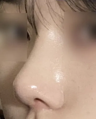 特別好的是，他們會考慮與臉部比例相稱的鼻子。