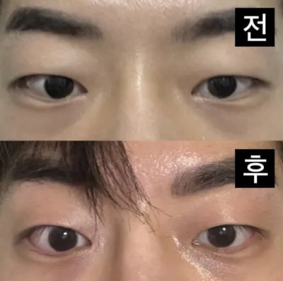 不僅眼睛，鼻子也超級成功