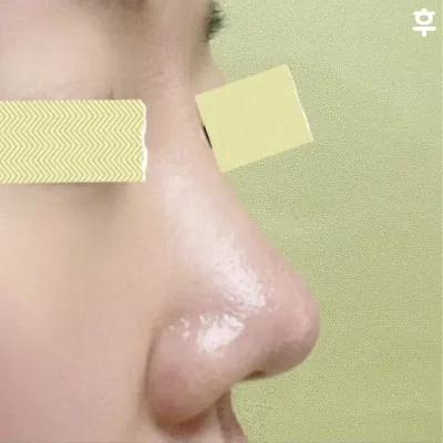 我真的覺得隆鼻是我人生中做出的最佳選擇！