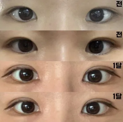 和擔心的不同，變化明顯，非常滿意！