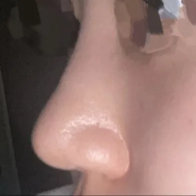 太好了ㅠㅠㅠ 謝謝院長..