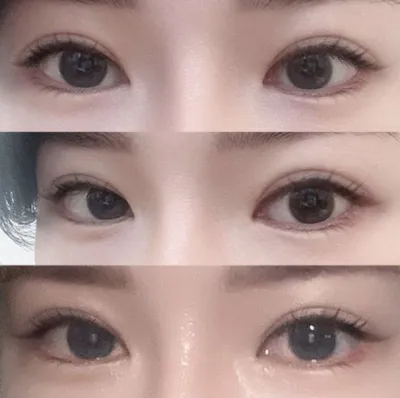 如果需要重做手術，大家都去Weverse吧！！哈哈哈