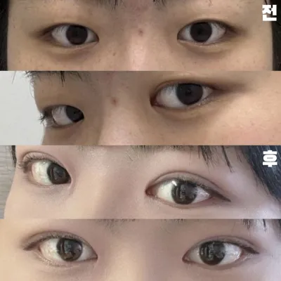 感謝您細心地為我治療，不讓我感到疼痛。