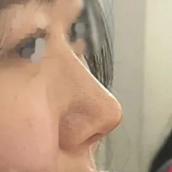 現在滿意度太高了，總是照鏡子感嘆...